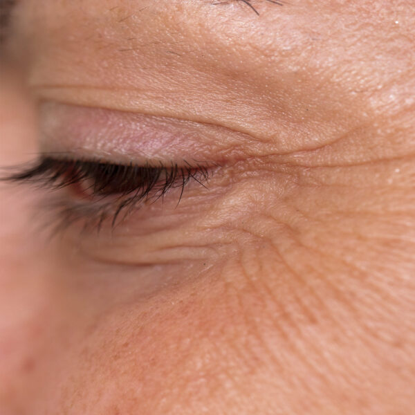 Ageing Insights – what you need to know - NEW